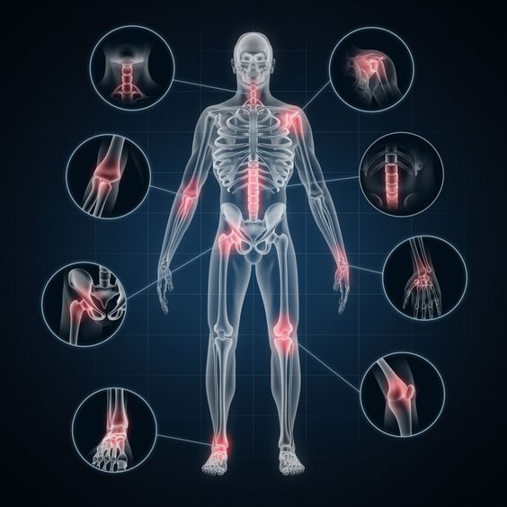 통풍 증상&#44; 원인&#44; 관리&#44; 주의 사항 : 퓨린과 요산