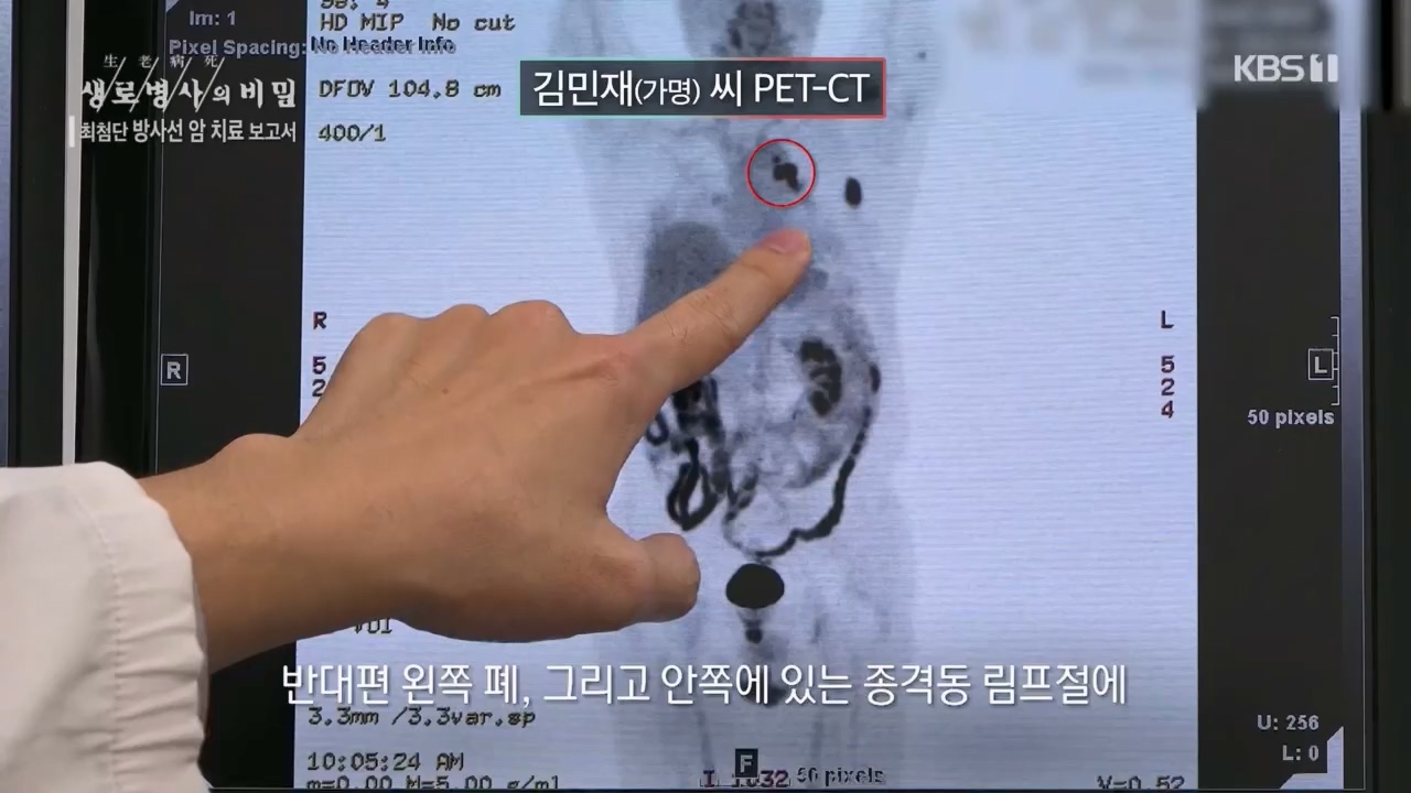 생로병사의 비밀.E896.240132p.H264-F1RST.mp4_20240202_195826.415.jpg