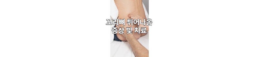 꼬리뼈 튀어나옴 원인 및 치료 꼬리뼈 튀어나옴 원인 및 치료