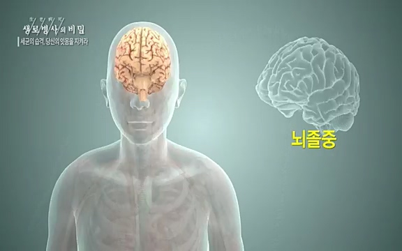 [792회] 생로병사의 비밀 - KBS[세균의 습격, 당신의 잇몸을 지켜라!] 감기보다 병원을 더 자주 찾게 만드는 질병이 있다. 바로 치주질환이다. 2020년 외래 다빈도 질병 1위를 차지한 치은염 및 치주질환 환자는 1,637_20220505_141601.023.jpg