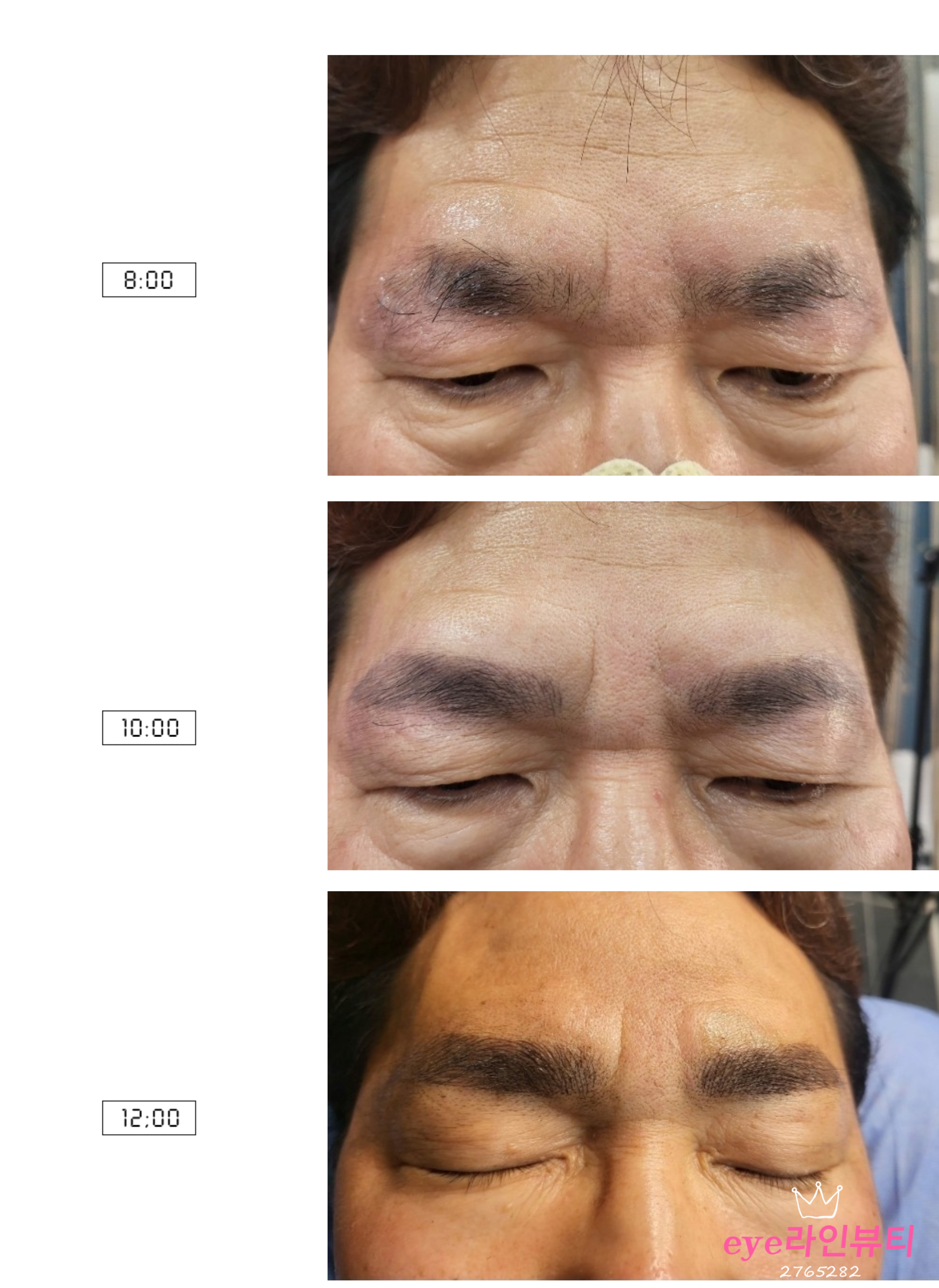  전주남자눈썹문신 콤보눈썹기법으로 리터치까지 총정리