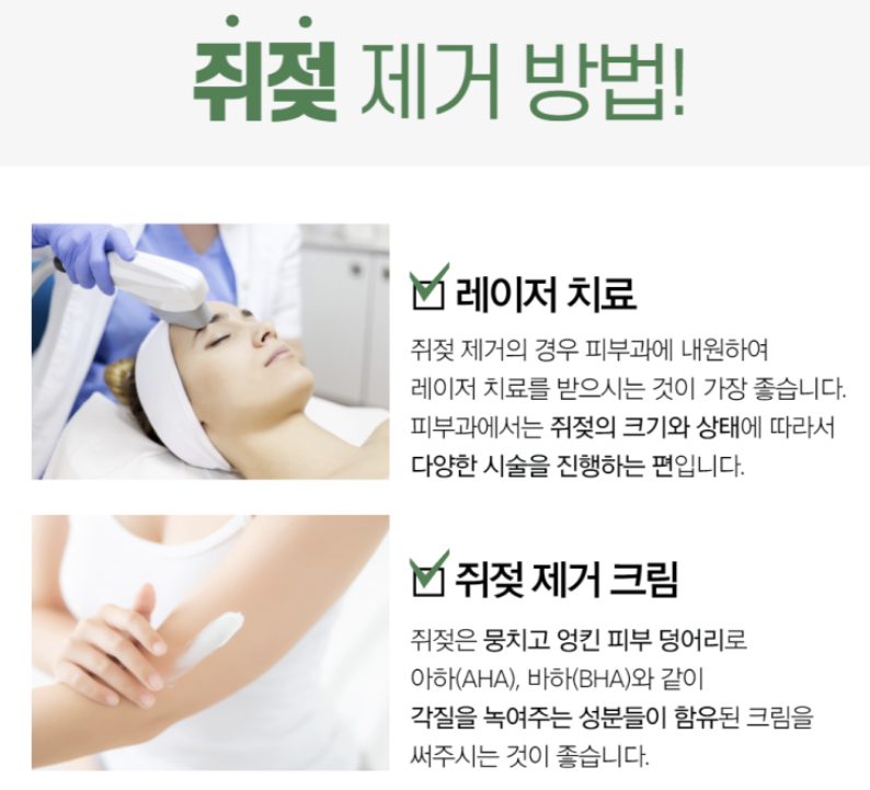 쥐젖 제거방법