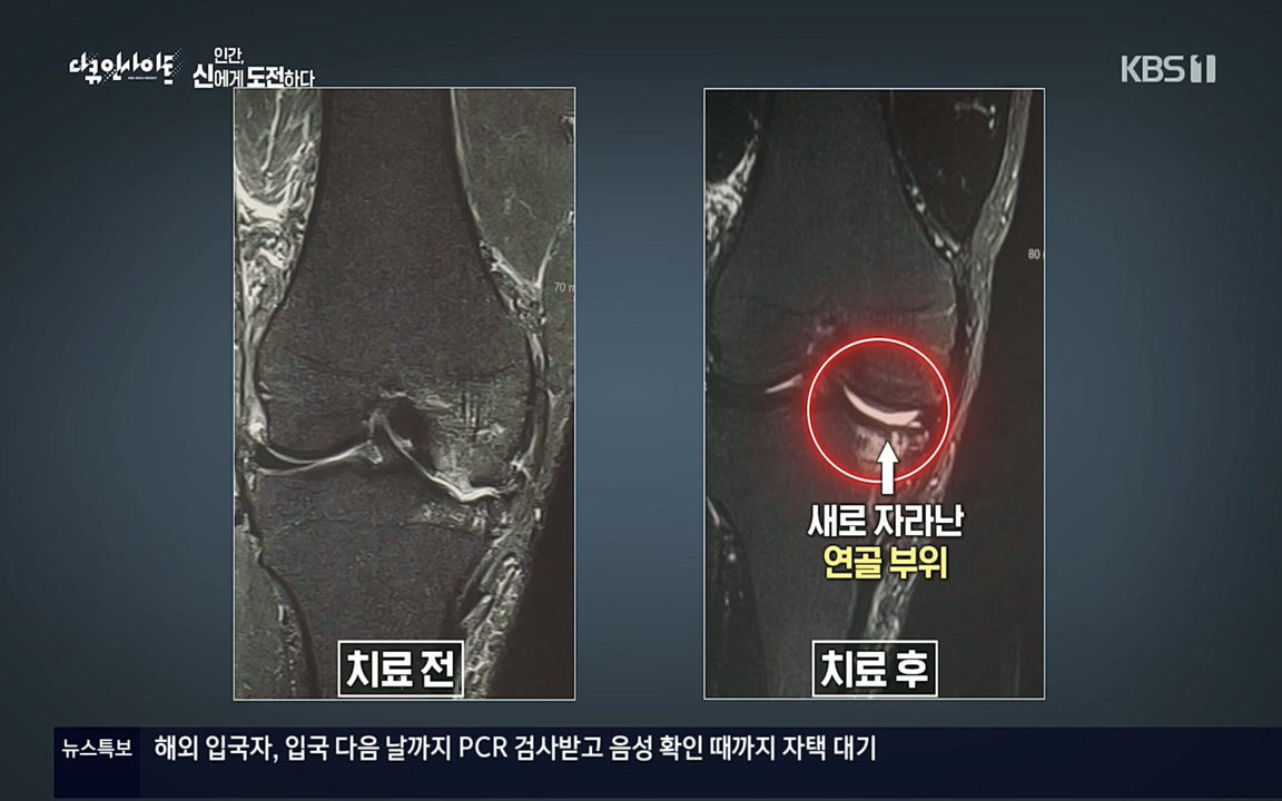 다큐 인사이트.E121.220819p.H264-F1RST.mp4_20220822_175606.746.jpg