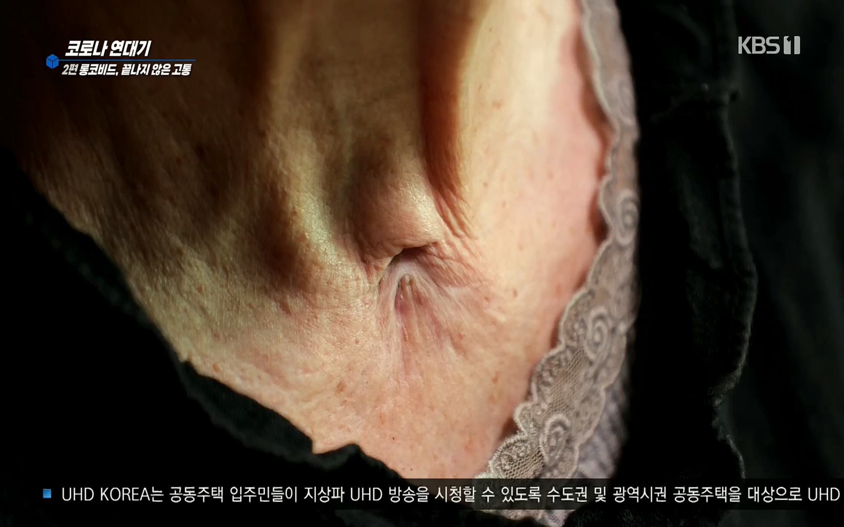생로병사의 비밀.E827.220720p.H264-F1RST.mp4_20220721_203843.994.jpg