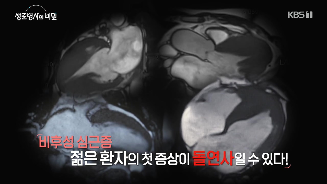 생로병사의 비밀.E912.240523p-NEXT.mp4_20240523_195832.371.jpg