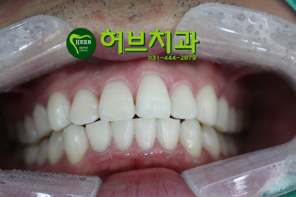 허브치과 이미지