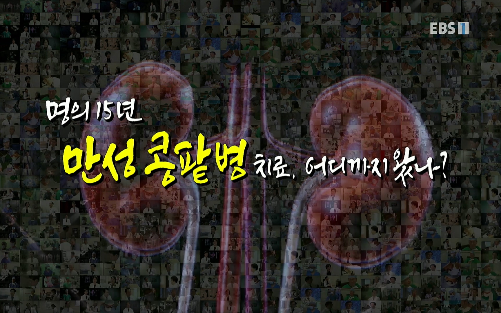 EBS 명의 헬스케어 - TV - 교육의 중심 EBS명의 15년 - 만성 콩팥병 치료, 어디까지 왔나- .mp4_20220802_202750.138.jpg