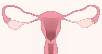 자궁내막증이란? 단순한 생리통과의 차이