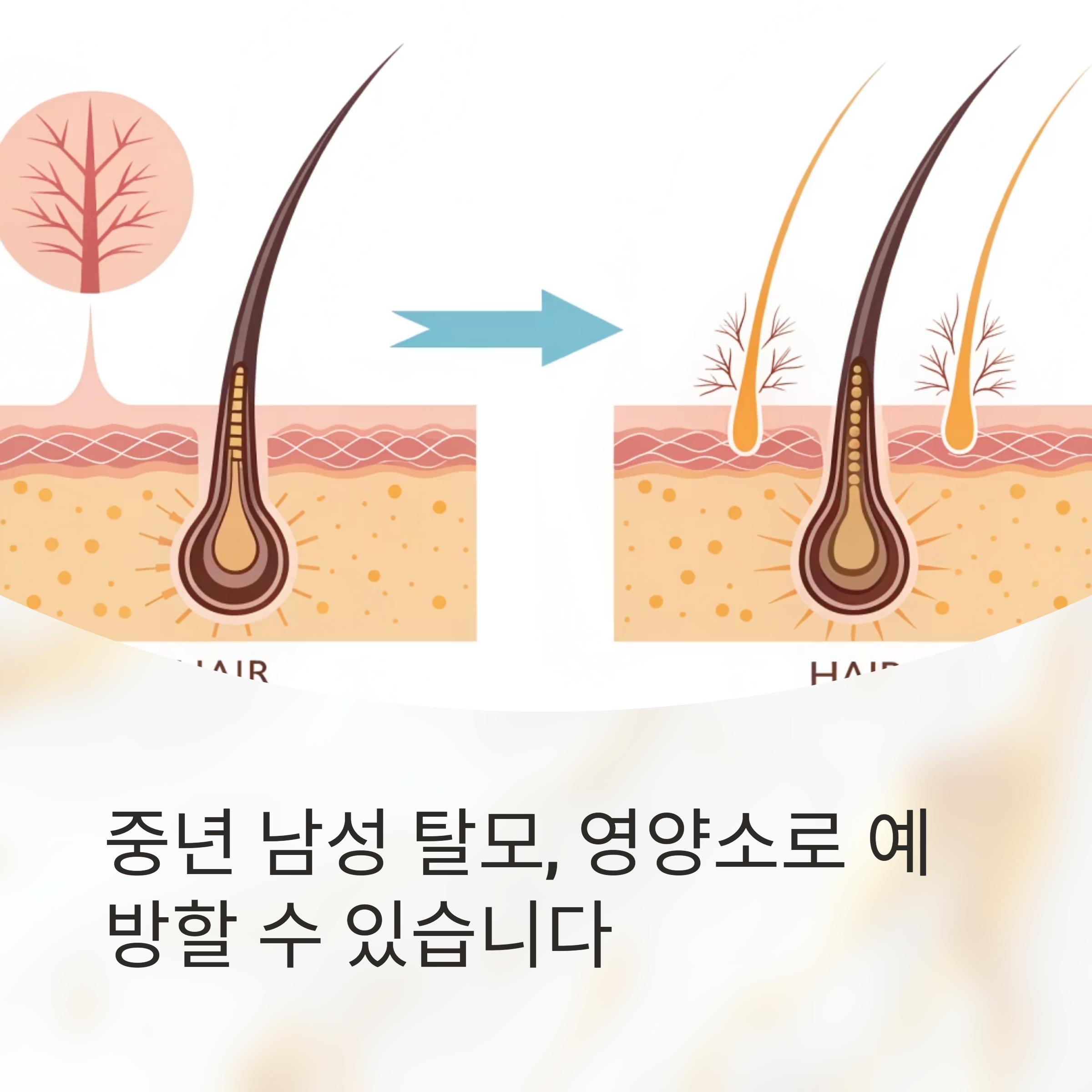 지금부터 챙겨야 하는 이유