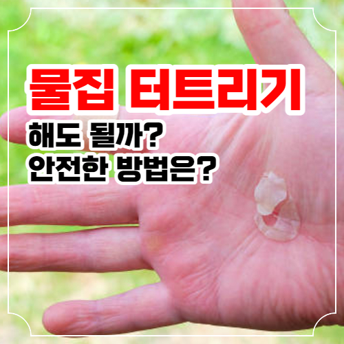 물집터트리기 필요할때와 치료 방법