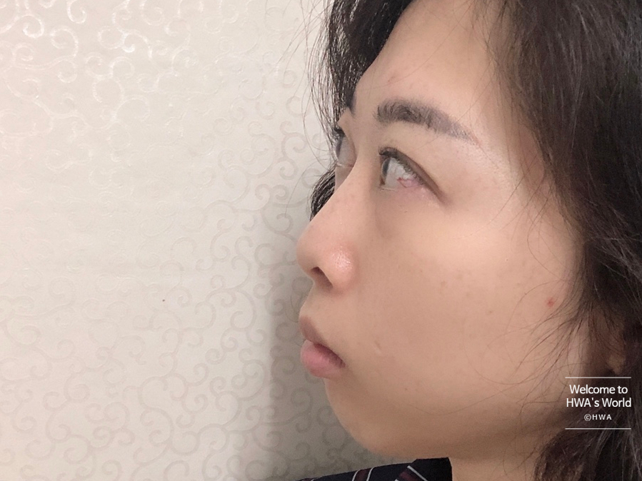 [강남/보스] 코볼 환원주사 - 리뷰 및 가격정보 14