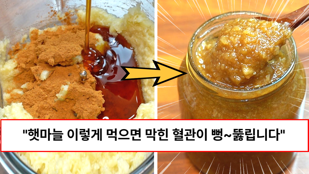 “생으로 먹지 마세요” 1년치 혈관청소부 햇마늘이 보이면 사서 이렇게 드세요