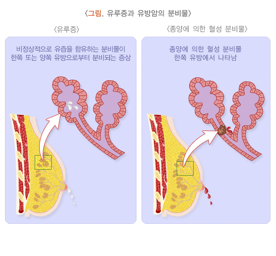  유루증