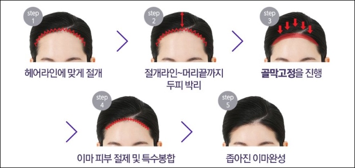 신논현역 금액축소가격과 리뷰를 잘보고