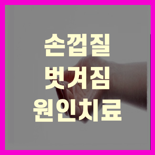 손껍질 벗겨짐 (+꼼꼼정리)