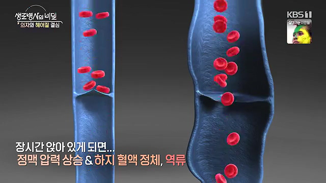 생로병사의 비밀 2024-11-27.mp4_20241128_200247.806.jpg