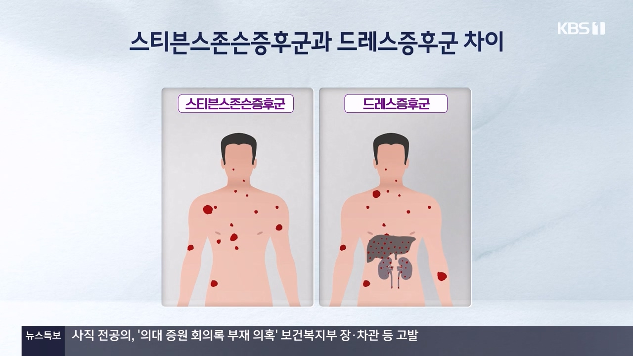 생로병사의 비밀.E910.240509p-NEXT.mp4_20240509_201129.125.jpg