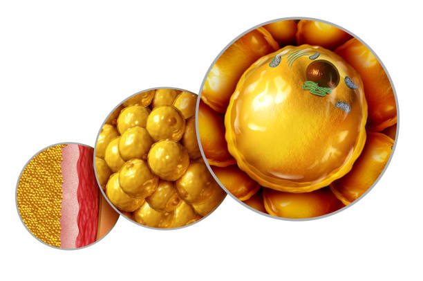 높은 중성 지방의 증상 요약 35