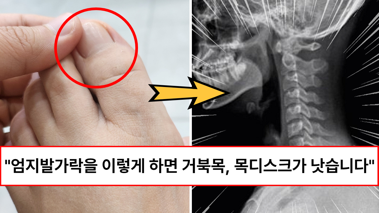 “한 번만 따라해도 목디스크가 낫습니다” 자세교정에 거북목까지 덤으로 치료된다는 일석이조 발가락 운동법