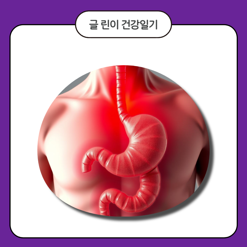 위암 3기 생존율은?