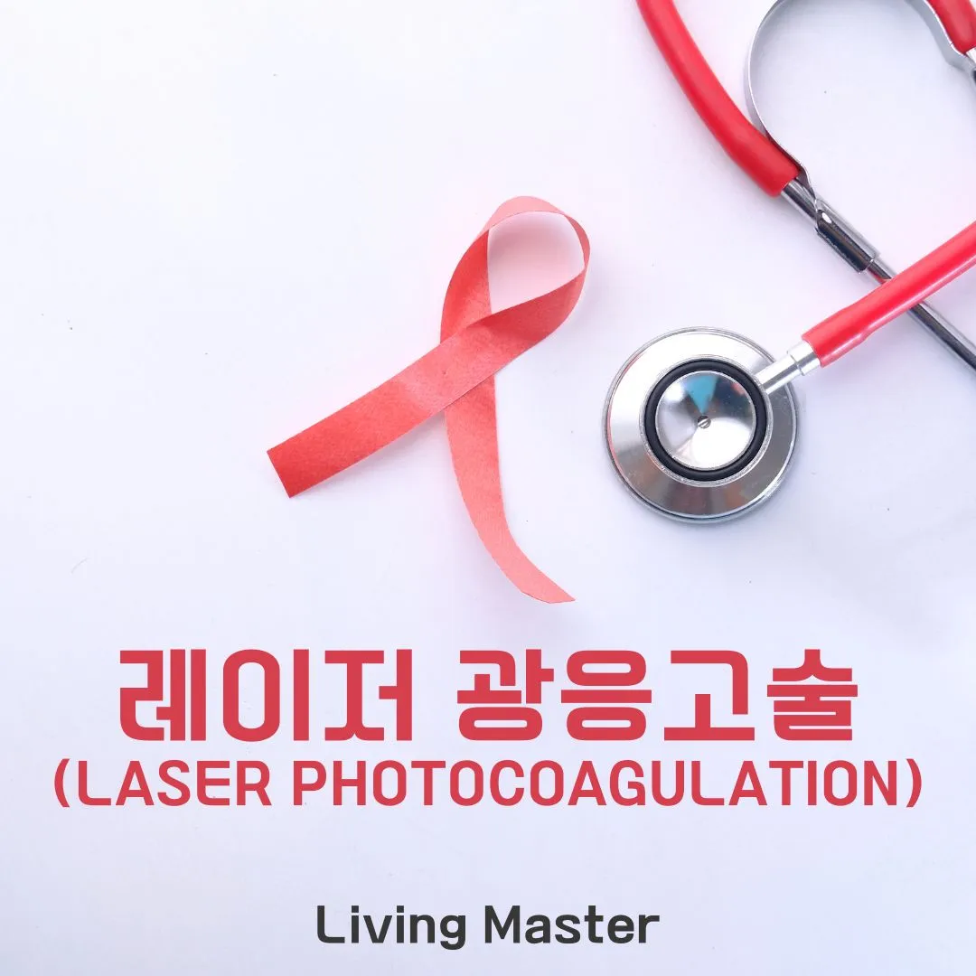 레이저 광응고술