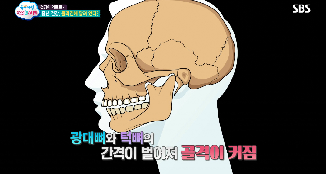  내 얼굴이 큰 이유 - 콜라겐