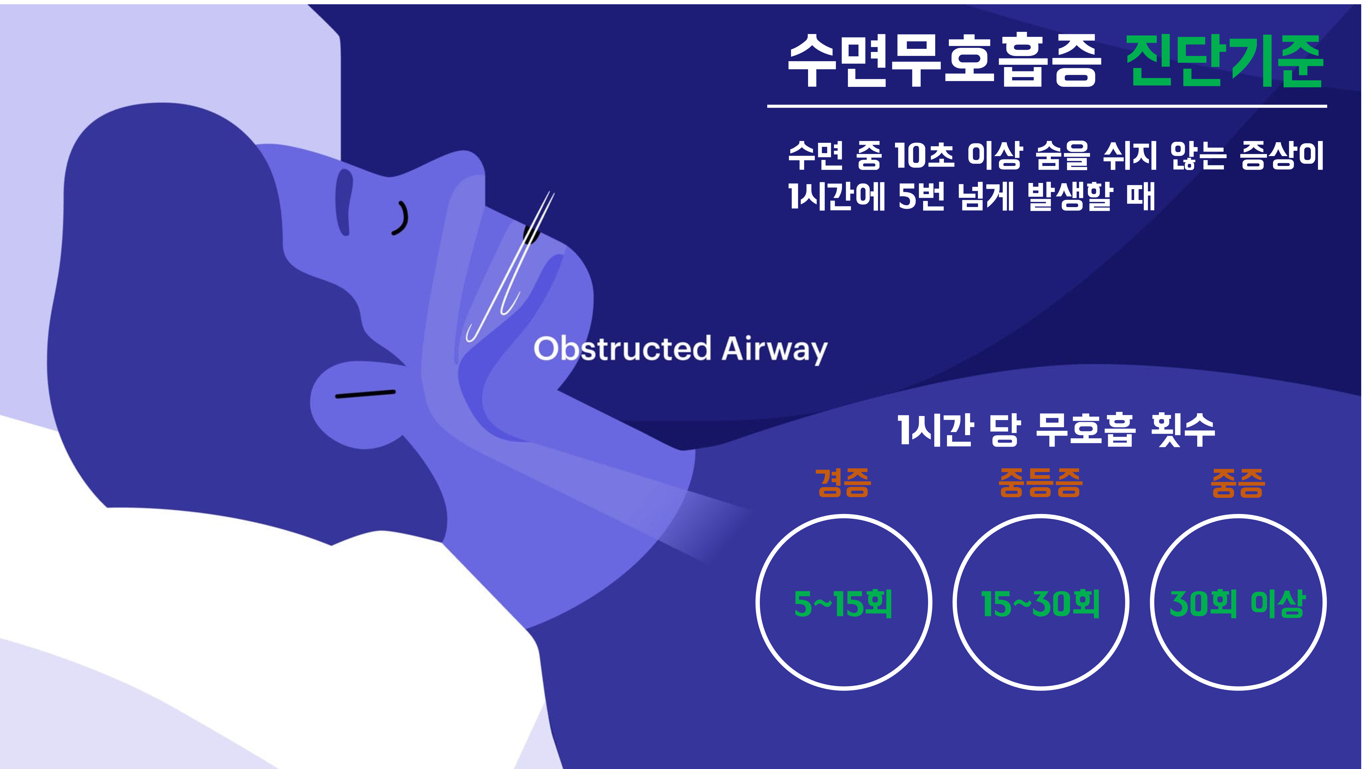 수면 무호흡증 진단기준