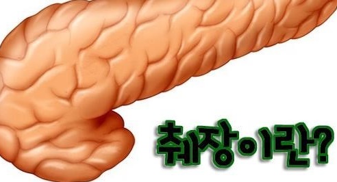  췌장염 증상 급성 췌장염, 만성 췌장염 치료 방법 알아봤습니다.