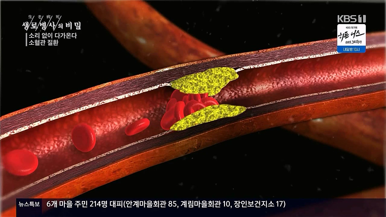 생로병사의비밀.E862.230309p.WANNA.mp4_20230309_194544.793.jpg