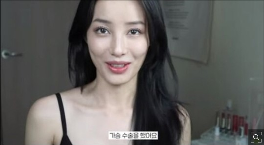  유튜버 유깻잎 가슴 수술 비글부부 임신 김조한 다이어트 최영재 태양의 후예