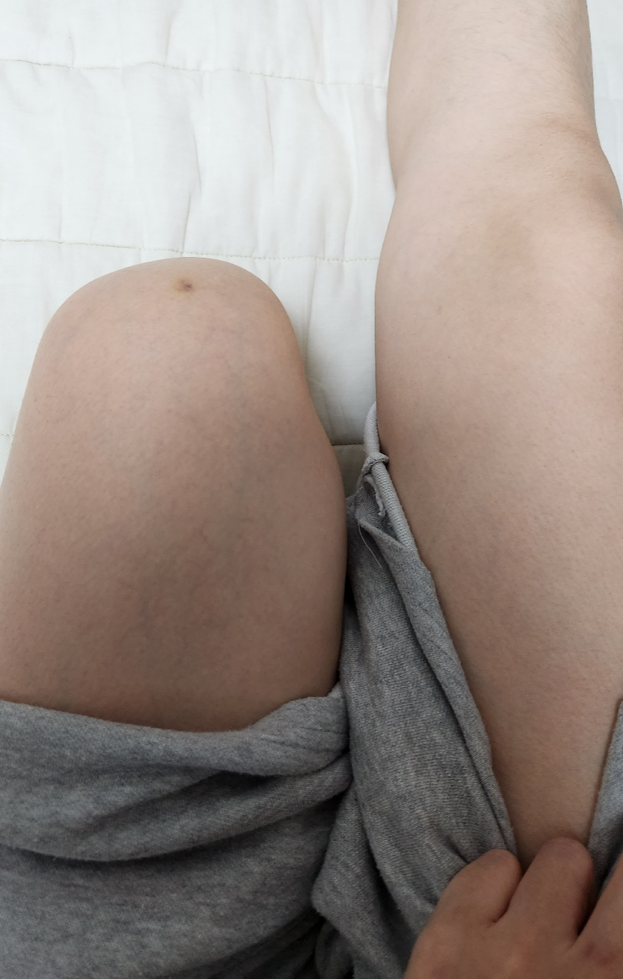  당뇨병 초기증상 5가지 가볍게 넘겼다가 1년 후 크게 후회하는 것?