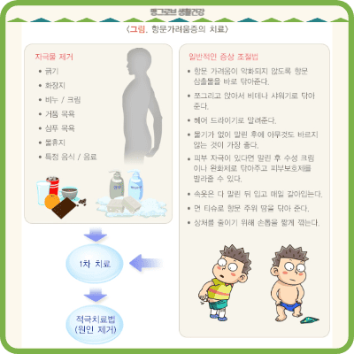 항문 가려움증의 치료 출처-질병관리청