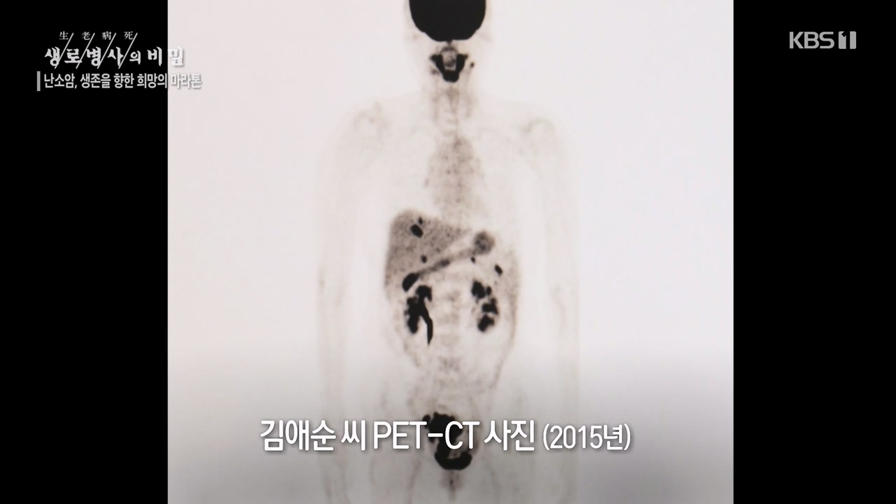 생로병사의 비밀.E878.230803p-NEXT.mp4_20230805_155638.392.jpg