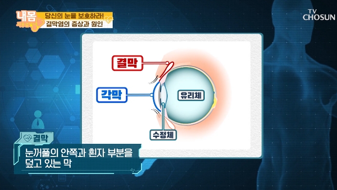  여름철 바이러스 결막염!! 방치하면 실명까지?!!