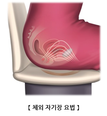 체외 자기장 요법