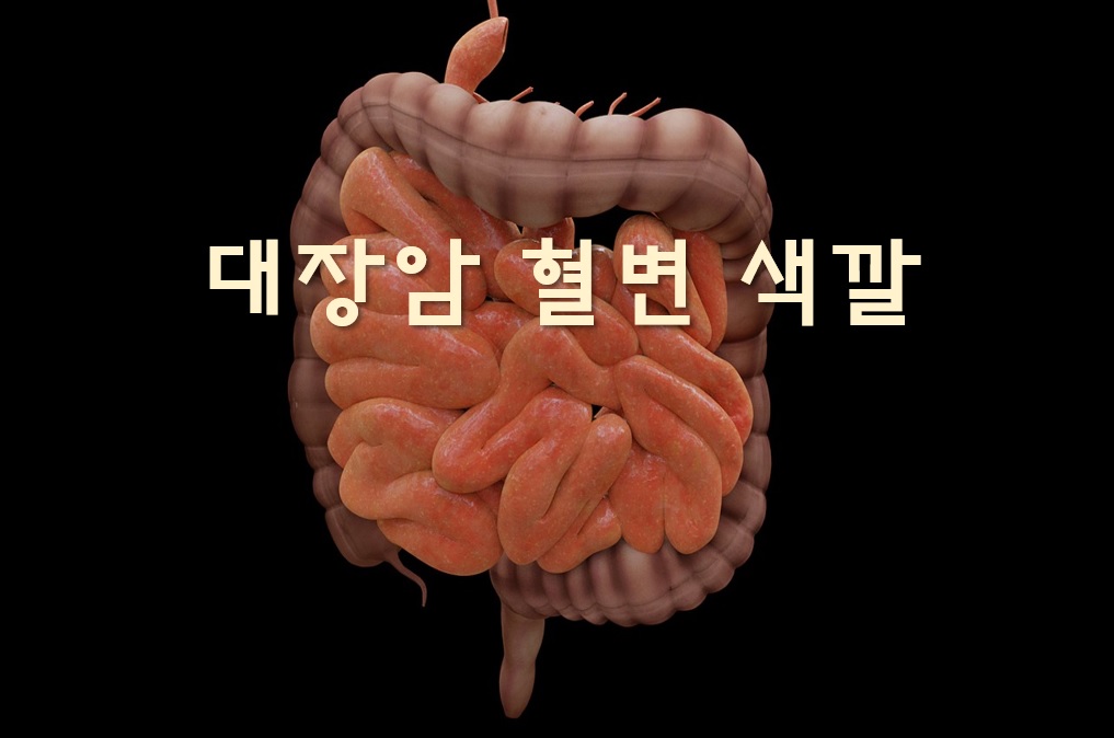  선홍색 혈변과 흑변, 대장암 혈변 색깔