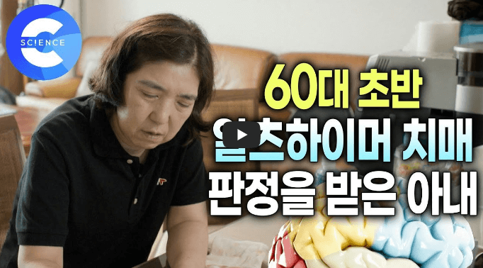 알츠하이머 초기증상 치매 예방 치료법