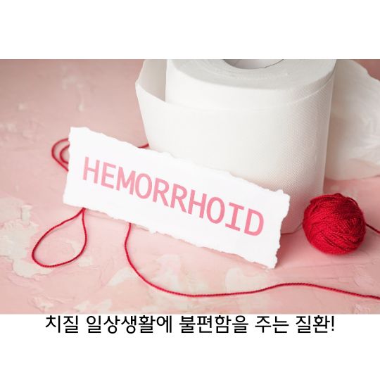  치질(hemorrhoid) 원인과 증상, 치료방법과 예방하는 방법