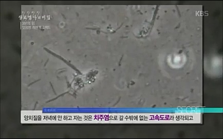 [670회] 생로병사의 비밀 - KBS670회] 생로병사의 비밀.ts_20220505_142158.736.jpg