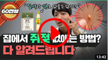 쥐젖의 원인과 증상&#44; 제거 방법