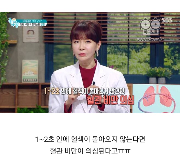  혈관비만 확인 방법