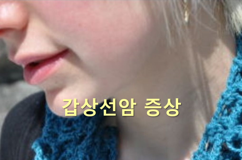  갑상선암 증상과 갑상선암 수술 후 회복기간