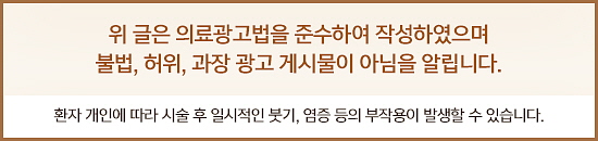 미간주름제거 4