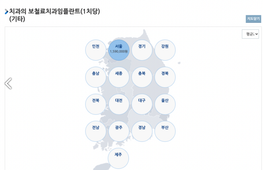 임플란트 지역별 평균가격