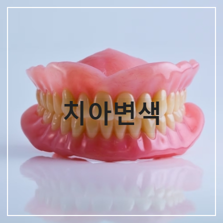 치아변색