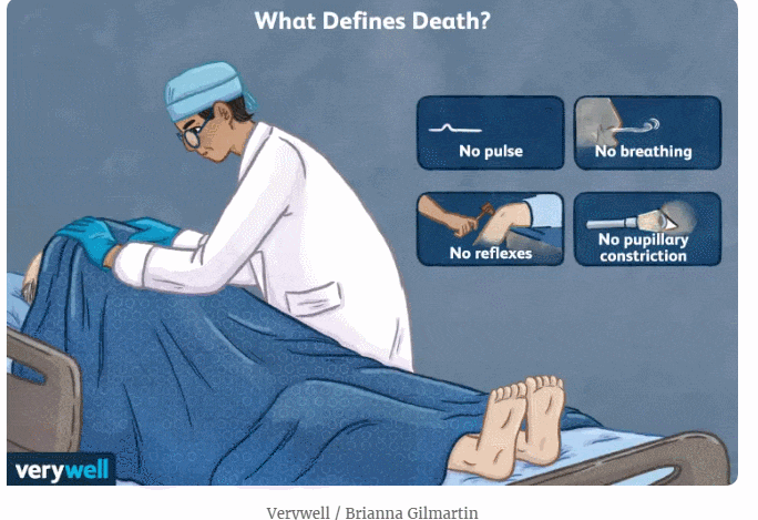 &#39;생물학적 죽음&#39;에 따른 몸의 변화 Here&#39;s What A Doctor Says Actually Happens When You Die