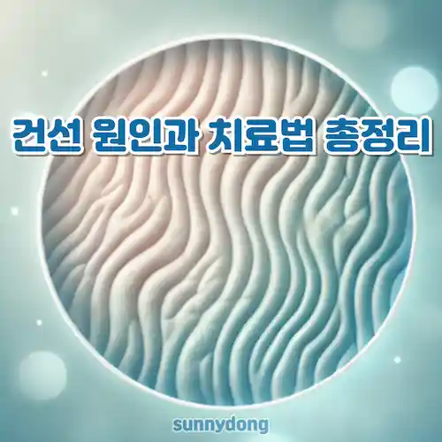 건선 원인과 치료법 총정리 썸네일