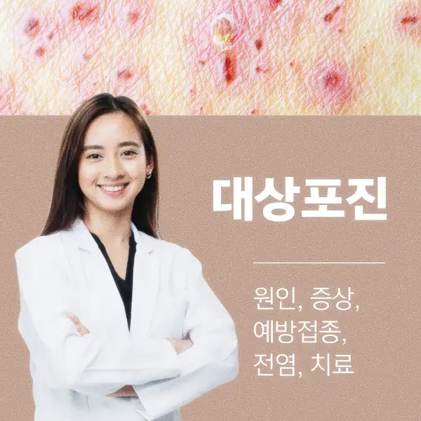 대상포진 원인&amp;#44; 증상&amp;#44; 예방접종&amp;#44; 전염&amp;#44; 치료