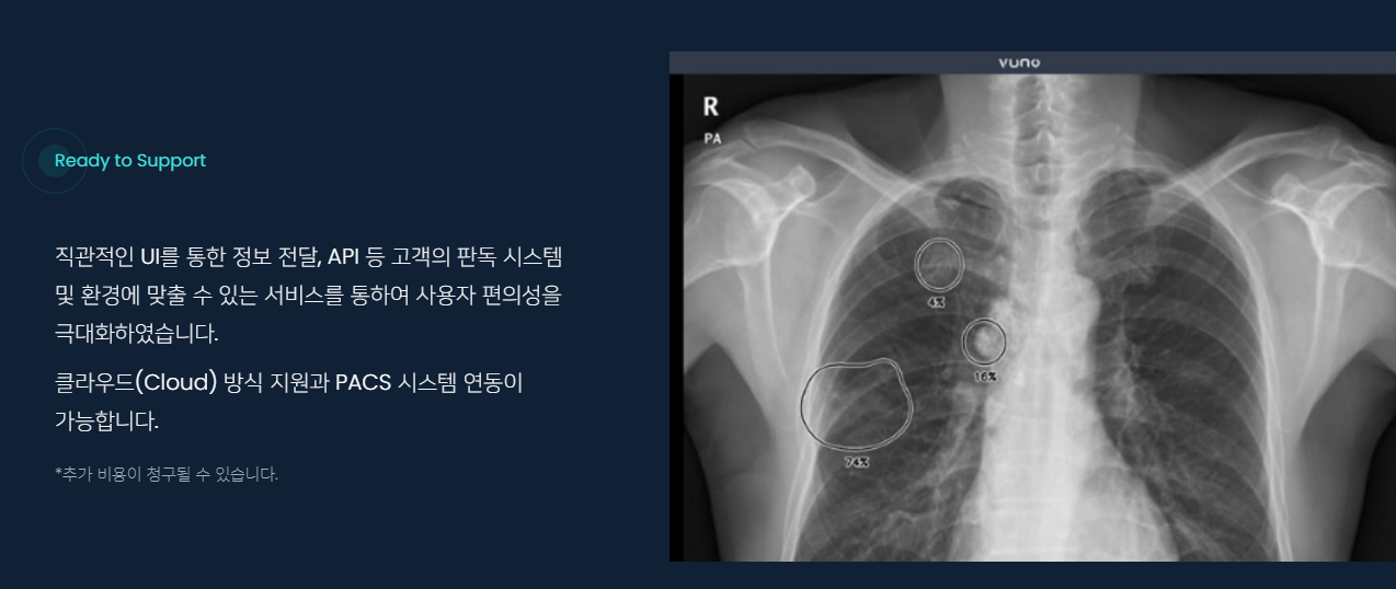 신규상장주 '뷰노'에 대해 모조리 알려드리겠습니다. 꼭 보세요~ 돈 벌려면 공부해야죠 ~!!