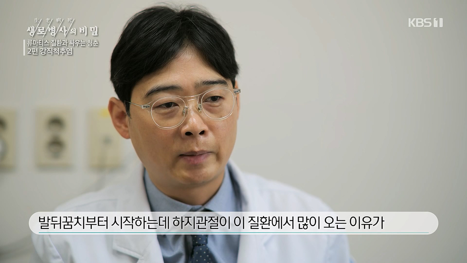 생로병사의 비밀.E861.230322p.H264-F1RST.mp4_20230323_204408.007.jpg
